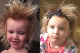 Girl has rare genetic disorder that makes her hair impossible to brush