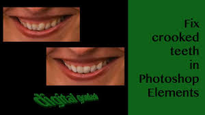 Ever have a photo that's crooked? How To Fix Crooked Teeth Photoshop Teethwalls