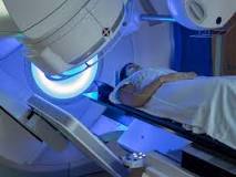 Image result for what is a boost in radiation treatment