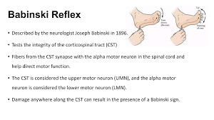 Image result for Babinski Reflex