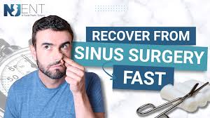 Image result for Sinus Surgery
