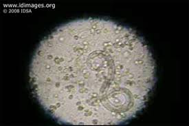 Image result for Strongyloides