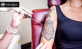 Es mucho más fácil cubrir los tatuajes que se aquí, la flor y la mano se moldean en las formas del nuevo tatuaje para ocultar cada lado sin tatuaje de calavera con flores de cerezo. Laser Para Eliminar Tatuajes Todo Lo Que Necesitas Saber