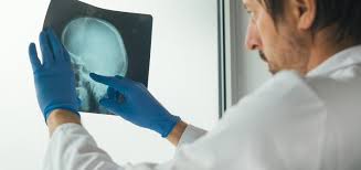 Subacute bacterial endocarditis is usually caused. Difference Between Post Acute Care And Subacute Care Bella Vista San Diego Ca