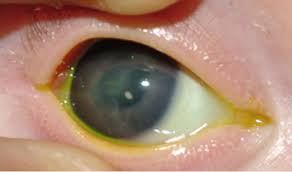 Neonatal herpes is a rare disorder affecting newborn infants infected with the herpes simplex virus (hsv), also called herpesvirus hominis. Herpes Simplex Ophthalmia Neonatorum A Sight Threatening Diagnosis British Journal Of General Practice