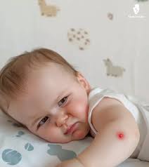 Image result for sores on the head in children