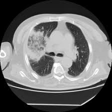 Mmc's technologists are highly trained and dedicated to educating patients, answering questions, and making patients feel comfortable during a procedure. Radiopaedia Org The Wiki Based Collaborative Radiology Resource