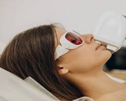 Image of Targeted Laser Hair Removal in Riyadh