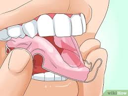 We did not find results for: How To Put On A Retainer 9 Steps With Pictures Wikihow