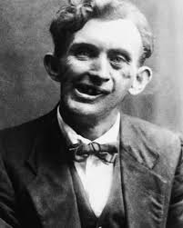 War veteran's story of survival and resilience after facial injury