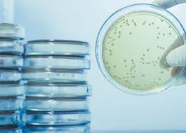 Statistiques et évolution des crimes et délits enregistrés auprès des services de police et gendarmerie en france entre 2012 à 2019 Legionellose Definition Symptomes Diagnostic Traitement Et Prevention