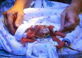 Your baby probably still needs to be propped another thing you'll notice at five months is that your baby's grasp is getting stronger. After 5 Months Premature Baby Weighs In At Nearly 8 Pounds Montana News Billingsgazette Com