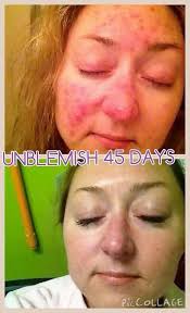 Alese Maxey's Instagram, Twitter & Facebook