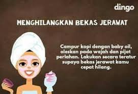 Pin Oleh Anggun Neila Zakiyah Di Herbal Life Perawatan Kulit Alami Produk Jerawat Perawatan Kulit