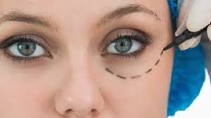 ارتفاع معدلات عمليات التجميل في بريطانيا - BBC News عربي