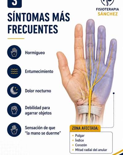 🖐️💥 ¿Hormigueo o adormecimiento en las manos? Podría ser síndrome del  túnel carpiano, una condición más común de lo que crees… y que no deberías  ignorar. El Dr. Kasdirt Narváez, especialista en