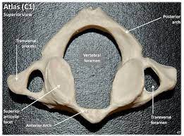 Check spelling or type a new query. Atlas C1 Vertebra Superior View With Labels Axial Skeleton Visual Atlas Page 47 Anatomy And Physiology Chiropractic Care Axial Skeleton