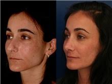 Ronald H. Schuster, MD