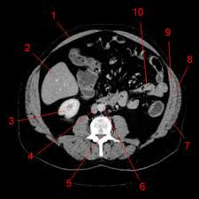 There is a dissection assistance pdf file that you can use to assist you in your lab preparation. Atlas Of Ct Anatomy Of The Abdomen W Radiology