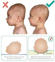 Luxe S Anti Flat Support Bed For Babies Baby Head Shape Flat Head Baby Baby Health