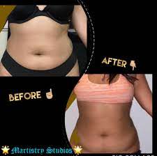 I had very little pain since my surgeon had given me a nerve block that he said would work for a week or more. Picassa Nyc After Only One Session Of Wood Therapy Facebook