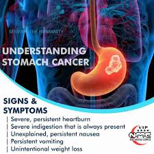 Cancer has spread into deeper layers of the stomach and maybe into nearby lymph nodes. Niazi Medical Complex And Teaching Hospitals Stomach Cancer Rates Have Fallen But Cancer At The Junction Of The Stomach And Esophagus Has Become More Common Know The Signs And Symptoms Of
