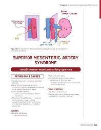 Nutcracker Syndrome Osmosis