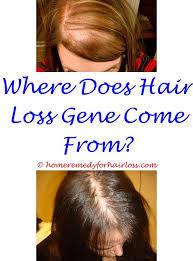 Pin On Hair Loss Causes