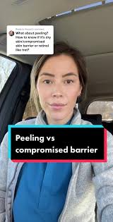 Peeling for Team Explained