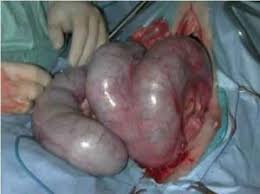 Süt İneklerinde Metritis - VetRehberi