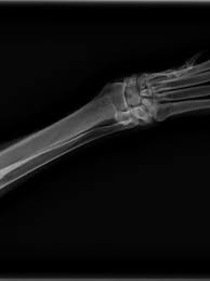 Bone cancer is a common cancer in dogs, especially in large and giant breeds. Is Your Dog Limping Canine Bone Cancer May Be Part Of The Diagnosis Kutv