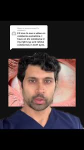 How to Get Rid of Colonoma Iris