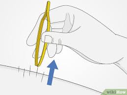 Tiene crecimiento en racimo de varias cabezuelas, cada una de ellas tiene de 2 a 4 cm de diámetro y puede. 3 Formas De Quitar Espinas De Cactus Wikihow