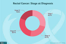 Rectal Cancer Symptoms Causes Diagnosis And Treatment Stage 4 cancer is the severest form of cancer.