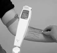 Visualization of veins when using the infrared device ...