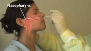 How long do test results take? Coronavirus Covid 19 Testing What You Should Know Uc Davis Health