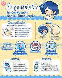 ผื่นกุหลาบในเด็ก โรคผื่นแพ้ยอดฮิตที่ลูกชอบเป็นตอนฤดูฝน