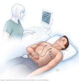 Electrocardiogram (ECG or EKG) - Mayo Clinic