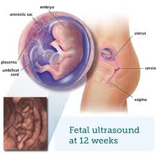 Image result for fetus 12 weeks old