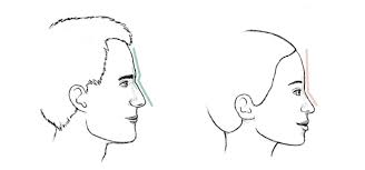 Maybe you would like to learn more about one of these? Facial Feminization Surgery 6 Facial Features That Can Make You Look Masculine 2pass Clinic