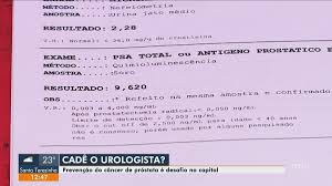 În mod obișnuit, psa este prezent în ser în concentrații reduse. Antigeno Prostatico Total Normal Psa Antigene Prostatico Specifico
