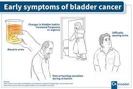 Although screening tests for bladder cancer are not conducted routinely, the following tests may be used to diagnose and learn more about bladder cancer: What Are The First Signs Symptoms Of Bladder Cancer