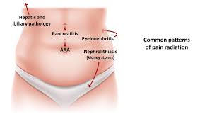 The lower left side of your abdomen is home to the last part of your colon, and for some women, the left ovary. An Approach To Acute Abdominal Pain Youtube