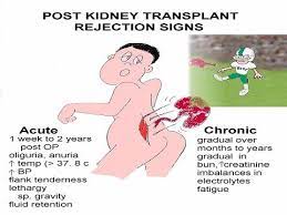Renal Failure Symptoms Assessment Causes And Nursing Care Nursing School Studying Nurse Nursing Study