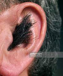 Then check a small area for hair removal. Ear Hair Removal Trimmer Cream Wax Laser Singeing Naturally Inner Canal Outer Best Way To Remove