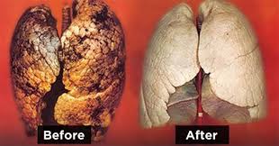 How To Purify Your Lungs See Results In 3 Days One Healthy Spot Healthy Detox Cleanse Clean Lungs Lung Cleanse