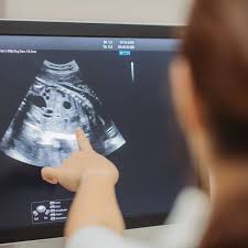 Medicare covers ultrasound for dense breast tissue when it is medically necessary. What To Expect At Your 12 Week Ultrasound