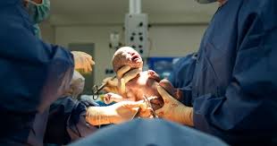 Para dokter juga tidak dapat menjelaskan secara pasti mengapa posisi sungsang bisa bayi dengan posisi letak sungsang terlebih anak pertama sebaiknya ditolong oleh tenaga. Bayi Keluar Ikut Pintu Atau Tingkap Bukan Ukuran Hebatnya Seorang Ibu Waktu Bersalin Pa Ma
