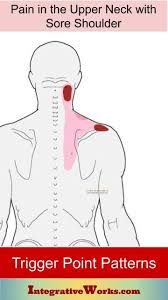 Pin On Pain