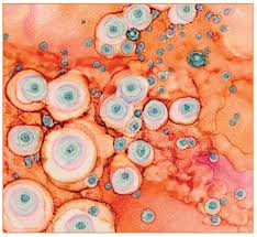 Maybe you would like to learn more about one of these? The Safe And Efficacious Use Of Secretome From Fibroblasts And Adipose Derived But Not Bone Marrow Derived Mesenchymal Stem Cells For Skin Therapeutics Jcad The Journal Of Clinical And Aesthetic Dermatology